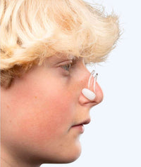 Watery nose clip - Active - Clear